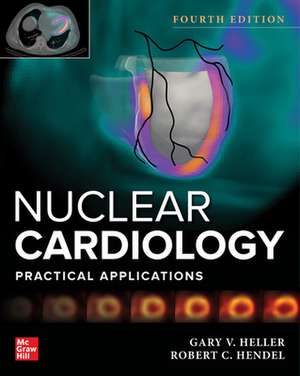 Nuclear Cardiology: Practical Applications, Fourth Edition de Gary Heller