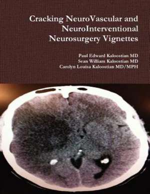 Cracking Neurovascular and Neurointerventional Neurosurgery Vignettes: The Personality Behind the Pen de Paul Edward Kaloostian MD