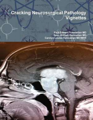 Cracking Neurosurgical Pathology Vignettes de Paul Edward Kaloostian MD