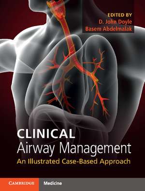 Clinical Airway Management: An Illustrated Case-Based Approach de D. John Doyle