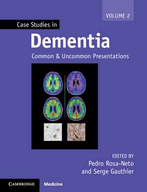 Case Studies in Dementia: Common and Uncommon Presentations de Pedro Rosa-Neto