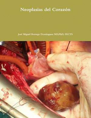 Neoplasias del Corazon de Jose Miguel Borrego Dominguez