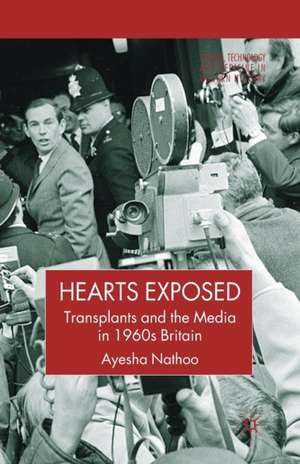 Hearts Exposed: Transplants and the Media in 1960s Britain de A. Nathoo