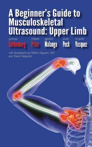 A Beginner's Guide to Musculoskeletal Ultrasound: Upper Limb de C. Price