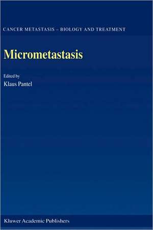 Micrometastasis de Klaus Pantel
