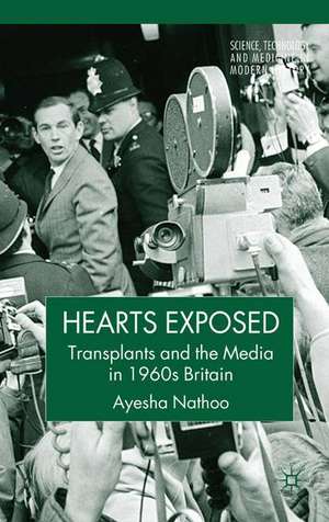 Hearts Exposed: Transplants and the Media in 1960s Britain de A. Nathoo