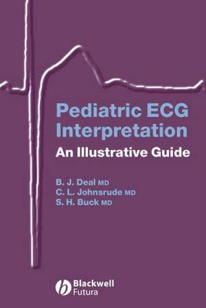 Pediatric ECG Interpretation de Barbara J Deal