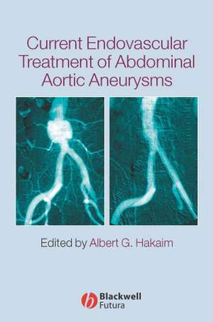 Current Endovascular Treatment of Abdominal Aortic Aneurysms de AG Hakaim