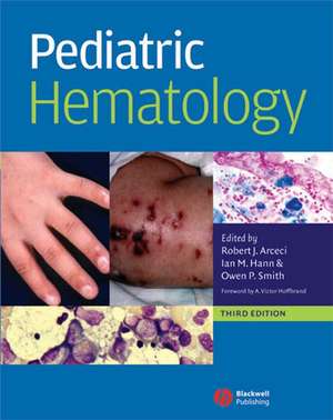 Pediatric Hematology de Robert J. Arceci