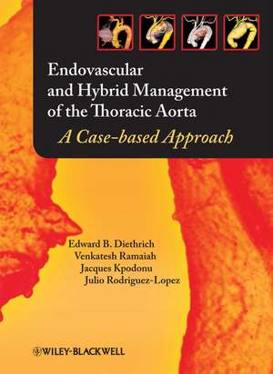 Endovascular and Hybrid Management of the Thoracic Aorta de J Kpodonu