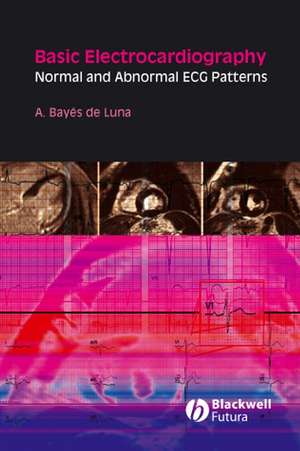 Basic Electrocardiography – Normal and Abnormal ECG Patterns de A Bayés de Luna