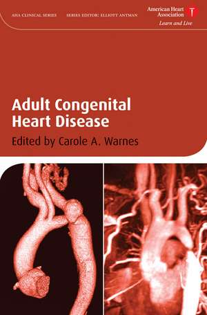 Adult Congenital Heart Disease de C Warnes