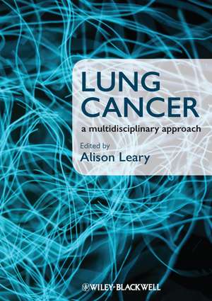 Lung Cancer – A Multidisciplinary Approach de A Leary