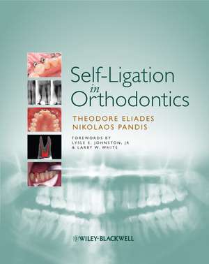 Self–Ligation in Orthodontics de T Eliades