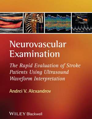 Neurovascular Examination – The Rapid Evaluation of Stroke Patients Using Ultrasound Waveform Interpretation de AV Alexandrov