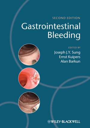 Gastrointestinal Bleeding de Joseph J Y Sung