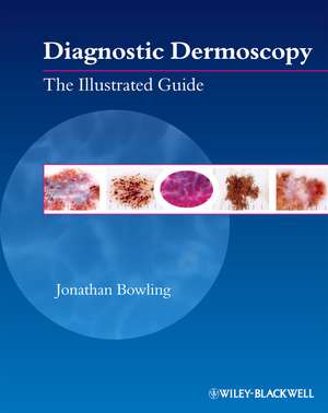 Diagnostic Dermoscopy: The Illustrated Guide de Jonathan Bowling