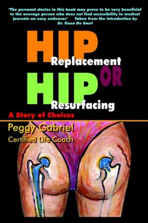 Hip Replacement or Hip Resurfacing de Peggy Gabriel