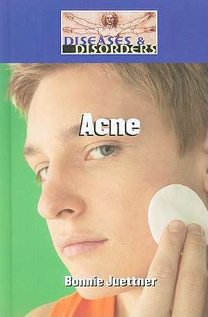 Acne de Bonnie Juettner