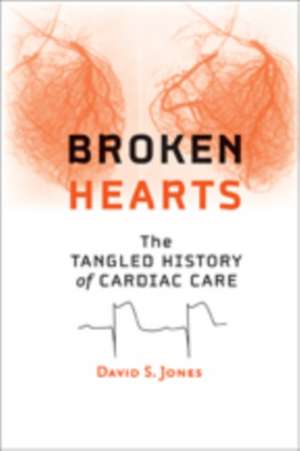 Broken Hearts – The Tangled History of Cardiac Care de David S. Jones