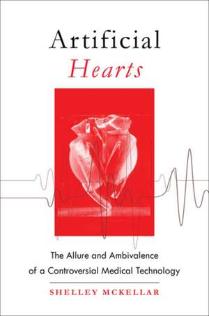 Artificial Hearts – The Allure and Ambivalence of a Controversial Medical Technology de Shelley Mckellar