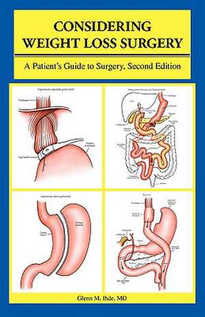 Considering Weight Loss Surgery de Glenn M. Ihde