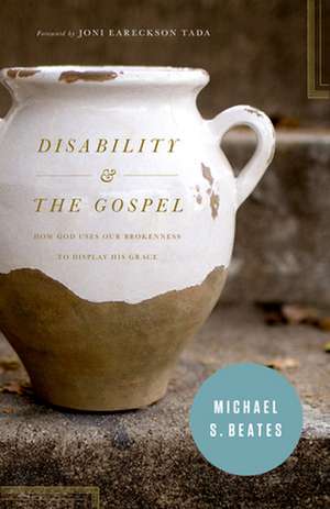 Disability and the Gospel – How God Uses Our Brokenness to Display His Grace de Michael S. Beates