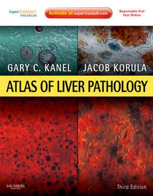 Atlas of Liver Pathology: Expert Consult - Online and Print de Gary C. Kanel