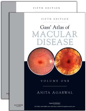 Gass' Atlas of Macular Diseases: 2-Volume Set - Expert Consult: Online and Print de Anita Agarwal