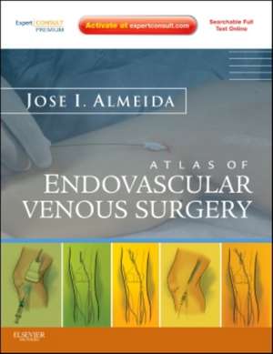 Atlas of Endovascular Venous Surgery: Expert Consult - Online and Print de Jose Almeida