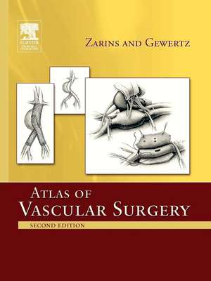 Atlas Of Vascular Surgery - Paperback Edition de Christopher K. Zarins