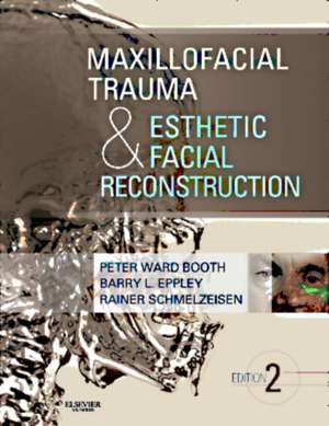 Maxillofacial Trauma and Esthetic Facial Reconstruction de Peter Ward Booth