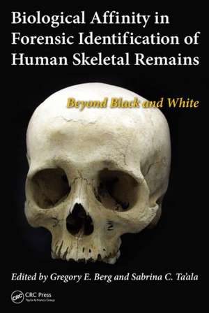 Biological Affinity in Forensic Identification of Human Skeletal Remains: Beyond Black and White de Gregory E. Berg