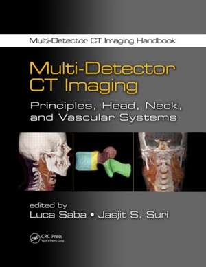 Multi-Detector CT Imaging: Principles, Head, Neck, and Vascular Systems de Luca Saba