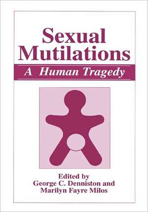 Sexual Mutilations: A Human Tragedy de George C. Denniston