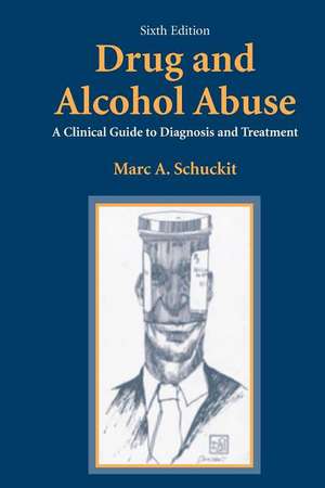 Drug and Alcohol Abuse: A Clinical Guide to Diagnosis and Treatment de Marc A. Schuckit