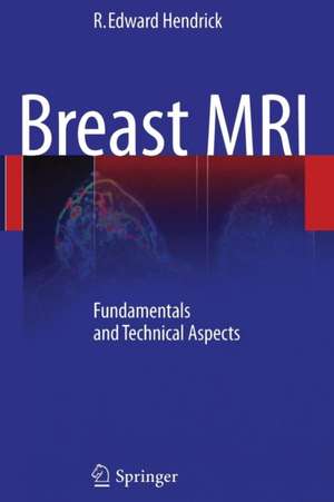 Breast MRI: Fundamentals and Technical Aspects de R. Edward Hendrick