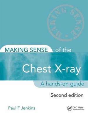 Making Sense of the Chest X-ray: A hands-on guide de Paul Jenkins