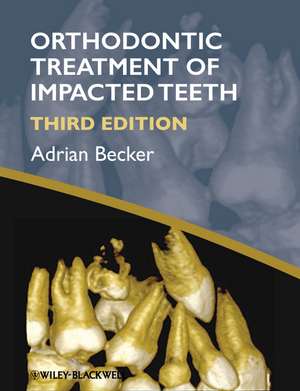 Orthodontic Treatment of Impacted Teeth 3e de A. Becker