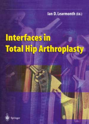 Interfaces in Total Hip Arthroplasty de Ian D. Learmonth