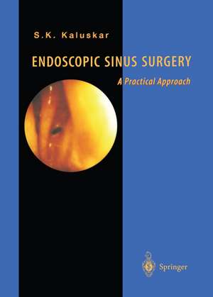 Endoscopic Sinus Surgery: A Practical Approach de Shashikant K. Kaluskar