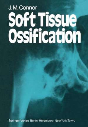 Soft Tissue Ossification de J. M. Connor