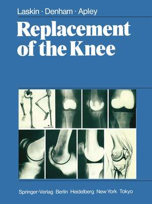 Replacement of the Knee de R.S. Laskin