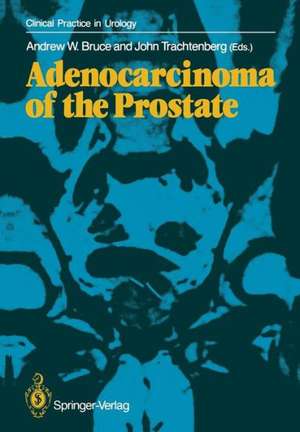 Adenocarcinoma of the Prostate de Andrew W. Bruce