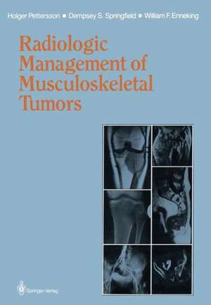 Radiologic Management of Musculoskeletal Tumors de Holger Pettersson