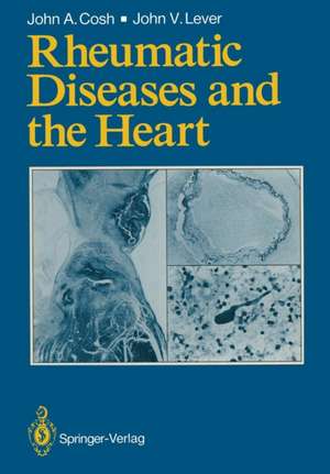 Rheumatic Diseases and the Heart de John A. Cosh