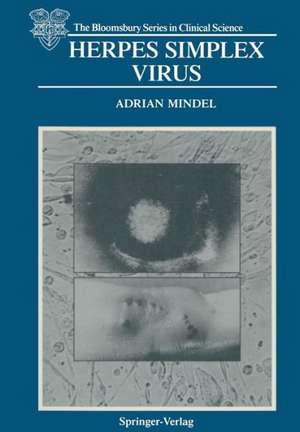 Herpes Simplex Virus de Adrian Mindel