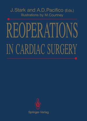 Reoperations in Cardiac Surgery de Jarda Stark