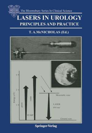 Lasers in Urology: Principles and Practice de Thomas A. McNicholas