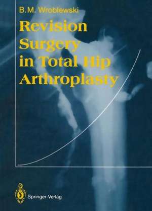 Revision Surgery in Total Hip Arthroplasty de Boguslaw M. Wroblewski